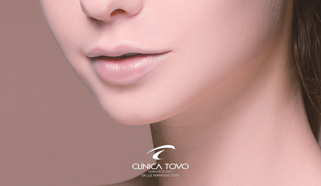 Tratamento do terço inferior da face (queixo duplo, flacidez de pescoço e de face) por radiofrequência invasiva