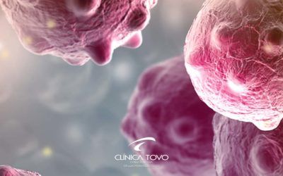 Câncer da Pele – II Simpósio Internacional de Oncologia Cutânea – Hospital Sírio Libanês – 05 à 06 de Abril 2018