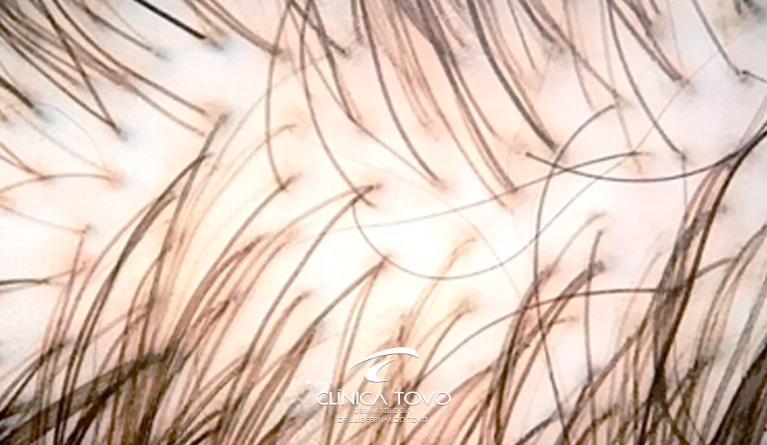 Diagnóstico Preciso para os Cabelos com o Tricolab – Conheça a Tecnologia