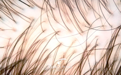 Diagnóstico Preciso para os Cabelos com o Tricolab – Conheça a Tecnologia