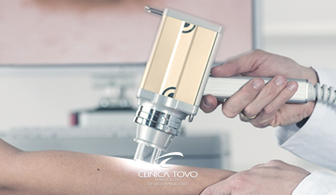 Dermatologista X Inteligência Artificial – Man Against the Machine