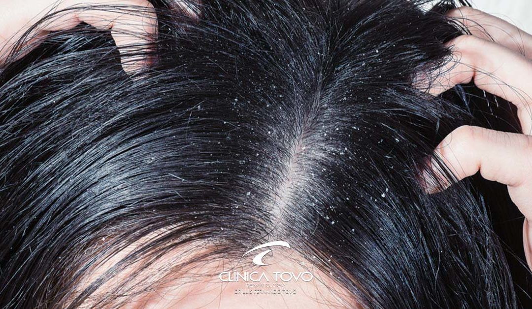 Caspas – Respondendo Duvidas mais Comuns