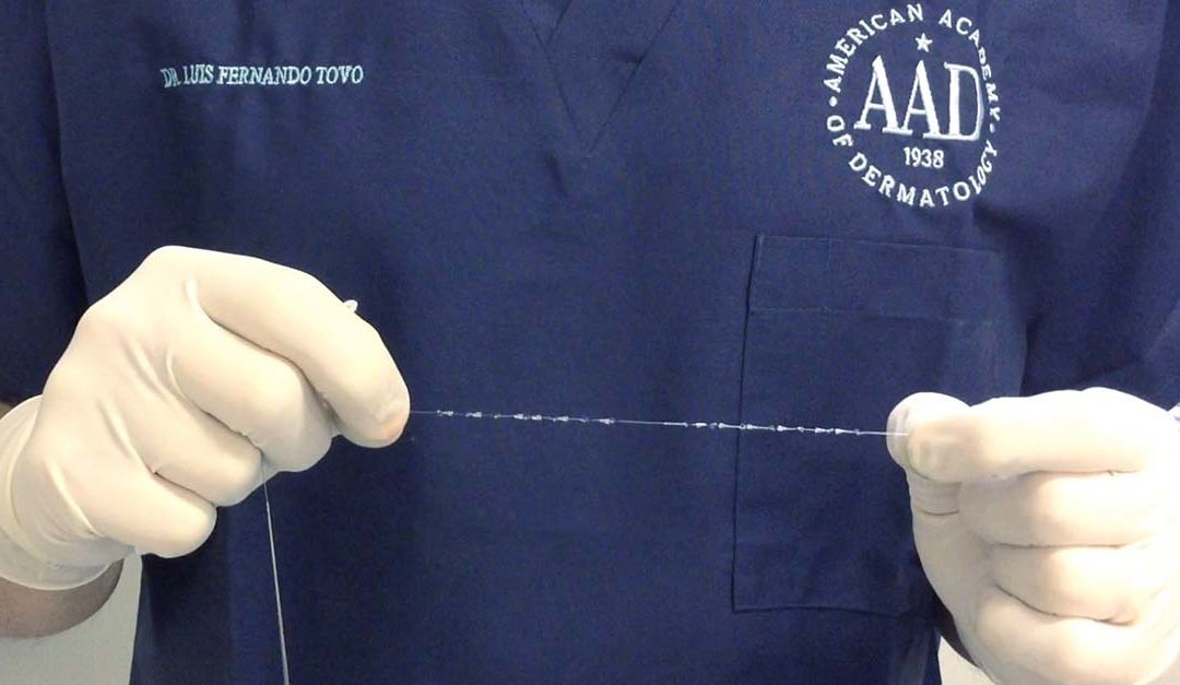 preenchedores-fios-de-sustentacao-facial-tovo-dermatologista-dr-tovo-luis-fernando-tovo-2