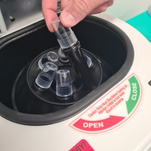 CLINICA TOVO PLASMA RICO EM PLAQUETAS